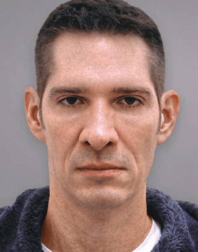 Male-Sample-Before-Ellanse Male-Sample-Before-Ellanse